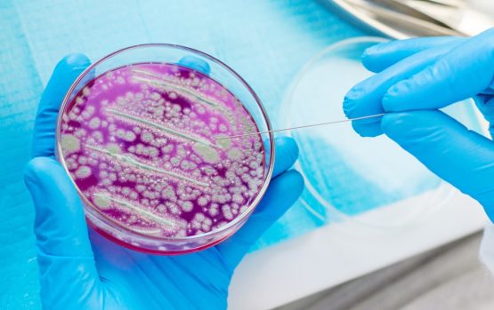 Examine,Bacteria,In,Petri,Dishes,In,The,Laboratory.,Selective,Focus. Suks Minhas Male Fertility Expert